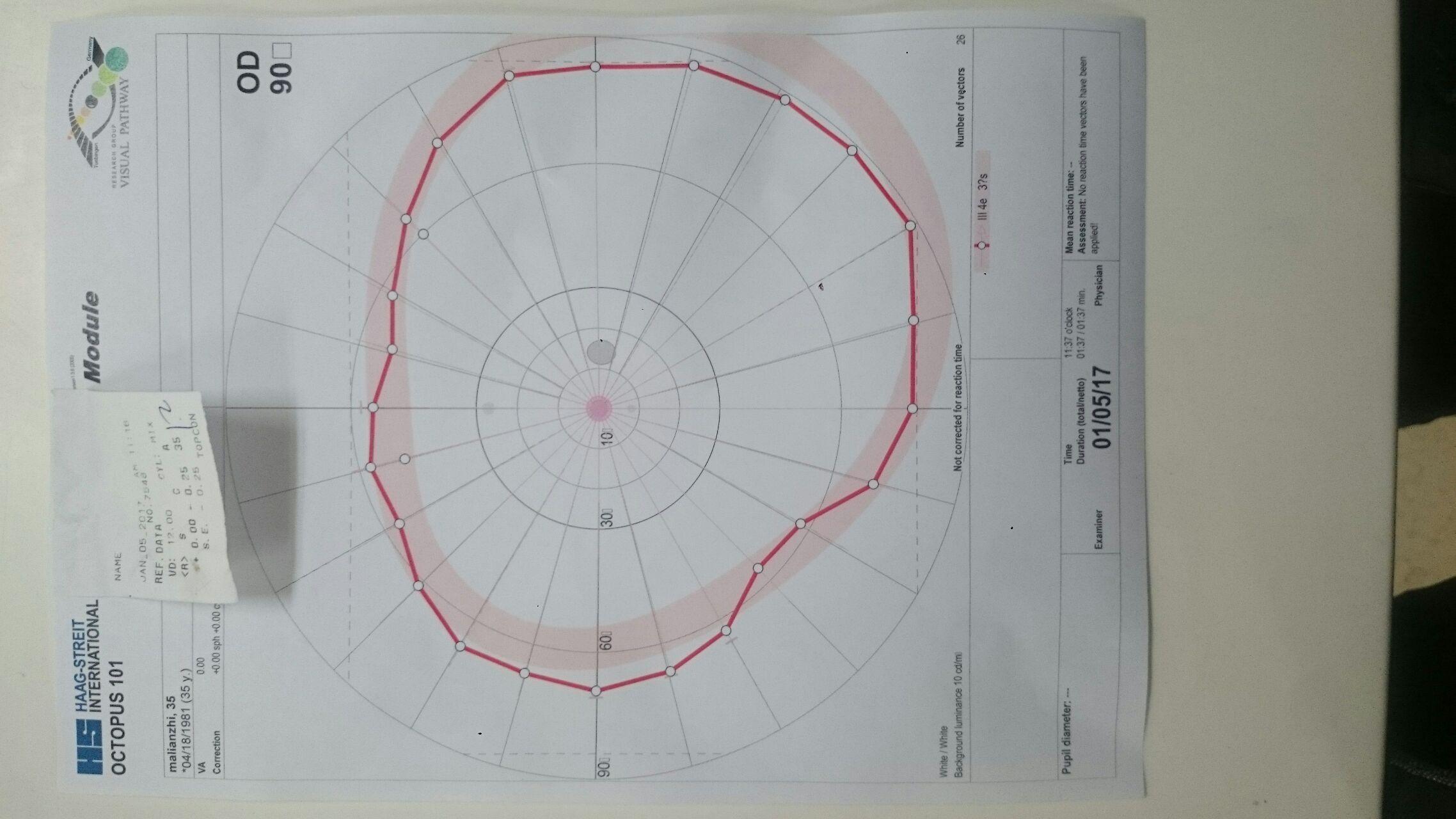 单眼水平视野150度是怎么检测的?