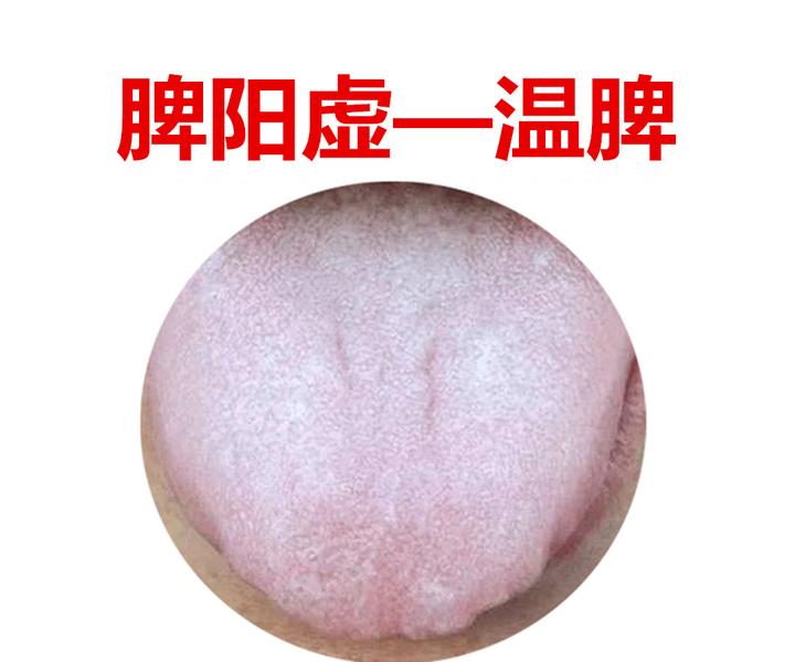 脾虚百病生,老中医教你几个养脾妙招,养好脾胃不生病 - 知乎