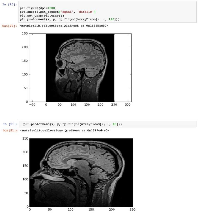 Python之深度学习分析医学图像实战基础I - 知乎