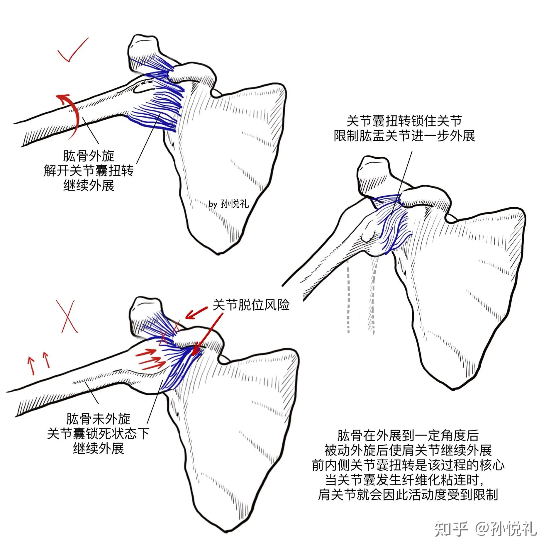 长旋的位置图解图片