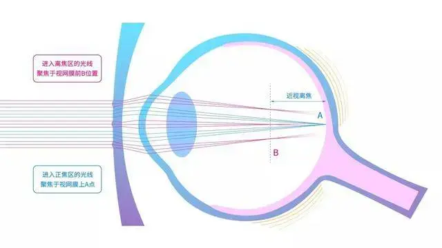 如何看待国内外各大手机厂商纷纷推出 AI Agent 智能体,方向对了吗?你怎么看?