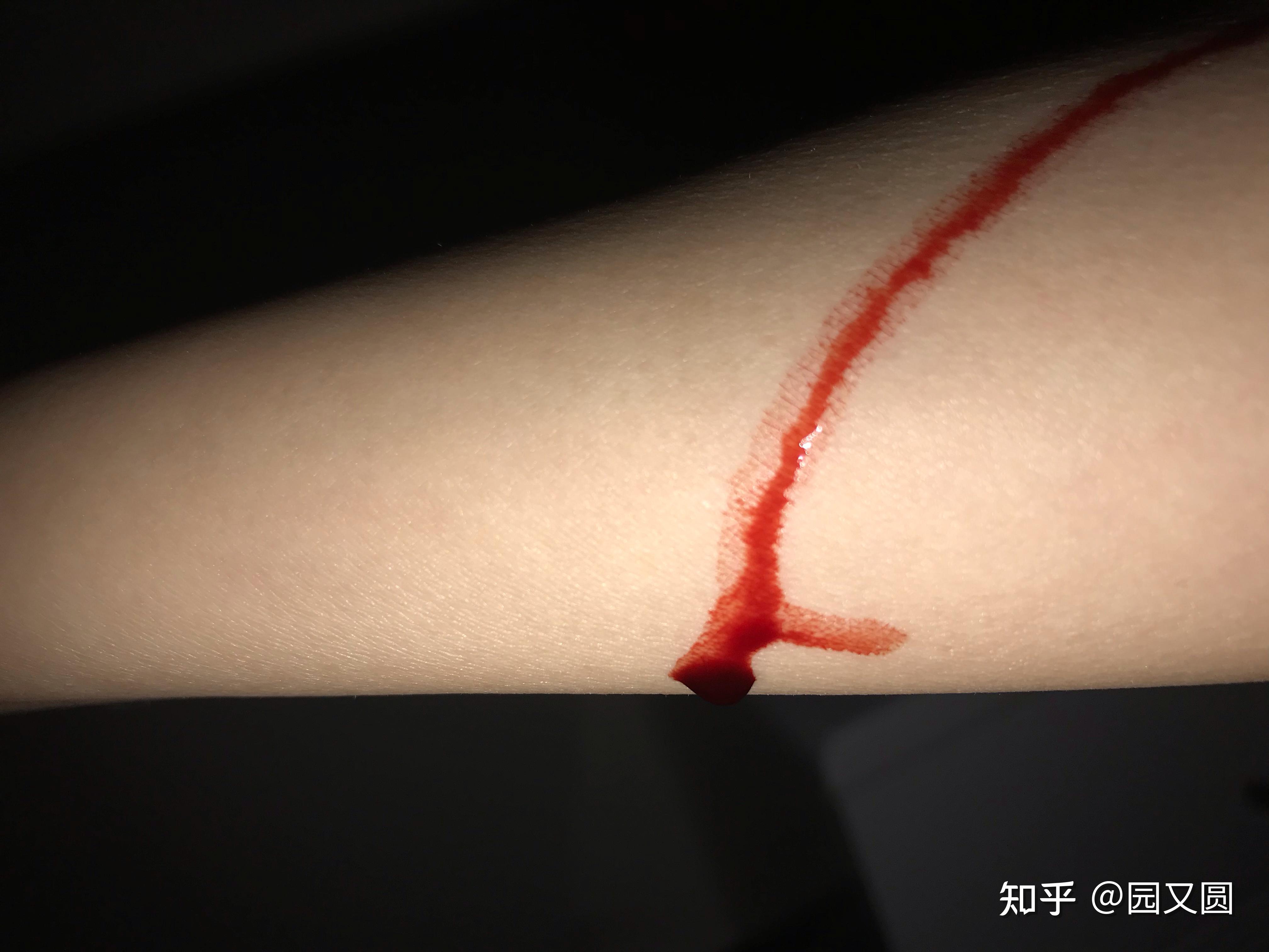 自残留下的疤真的很可笑吗?
