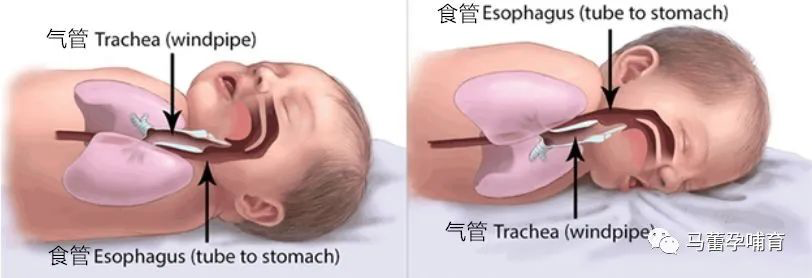 母乳喂养宝宝经常吐奶怎么办?宝妈们有知道的吗?