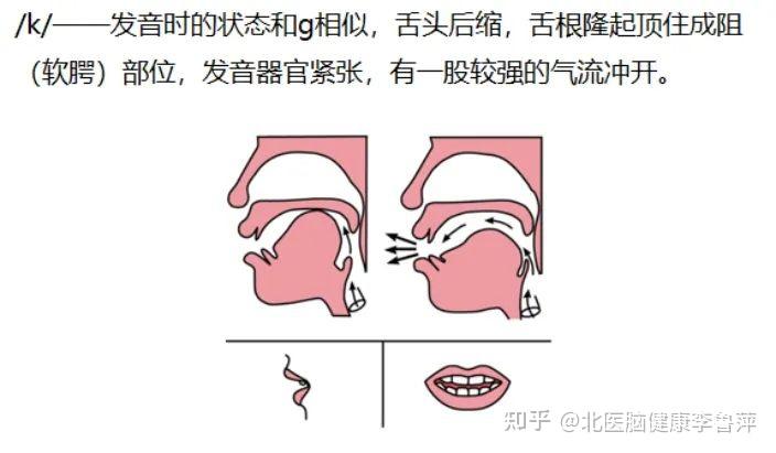  构音训练实操：舌根音g、k、h的训练方法及步骤 - 知乎 