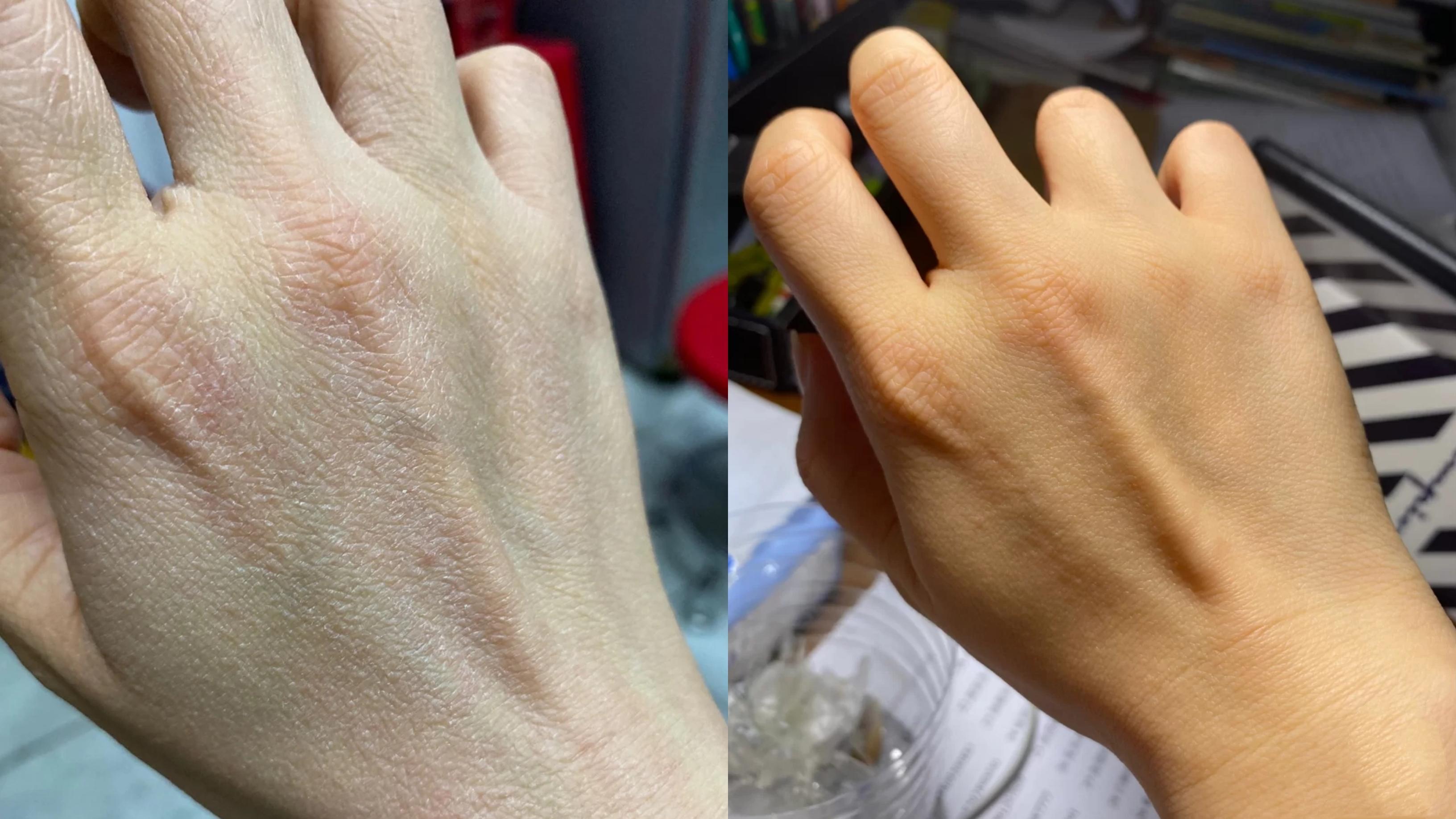 秋冬最值得入的4支神仙护手霜!做家务、皮肤干裂、脱皮掉屑、手黑粗糙的人一定要用护手霜!让你的手比脸还嫩!!! - 知乎