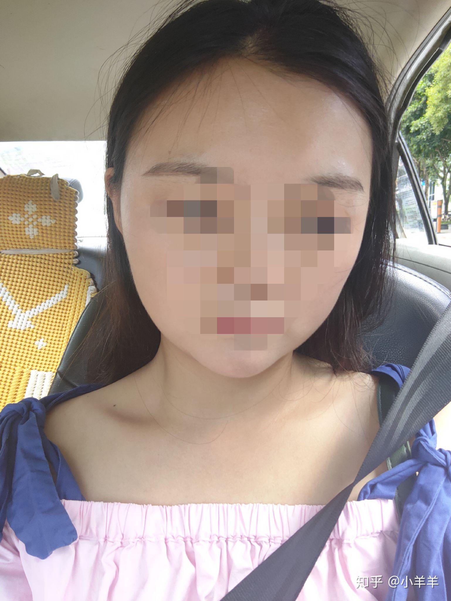 圆脸尖下巴是什么脸型