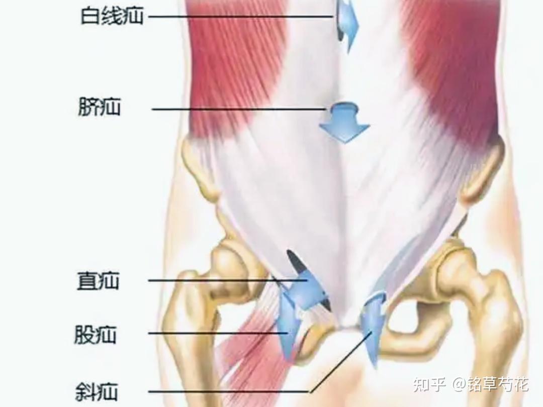 疝气有哪些常见的类型?