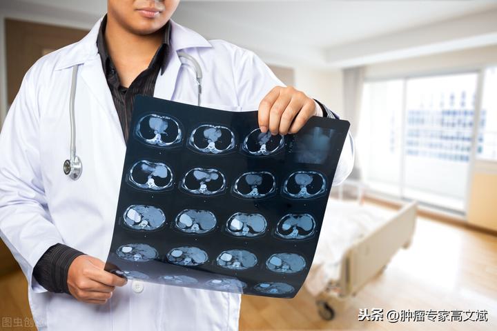 肺癌患者的临床随诊 - 知乎
