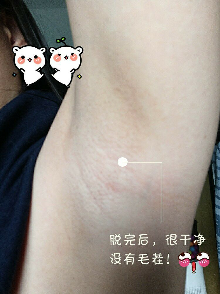 女生脫腋毛最好的方法有哪些