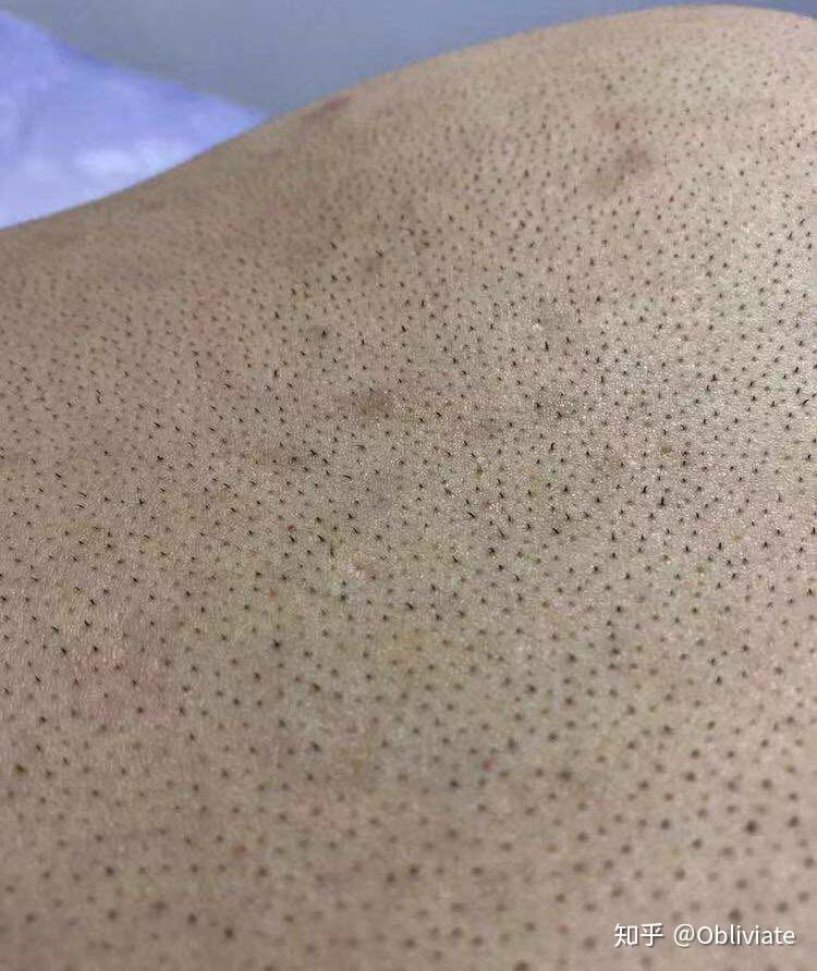 有哪些让人产生密集恐惧症图片