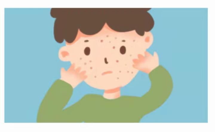 医生:身上长“瘊子” 竟然是hpv携带者? - 知乎