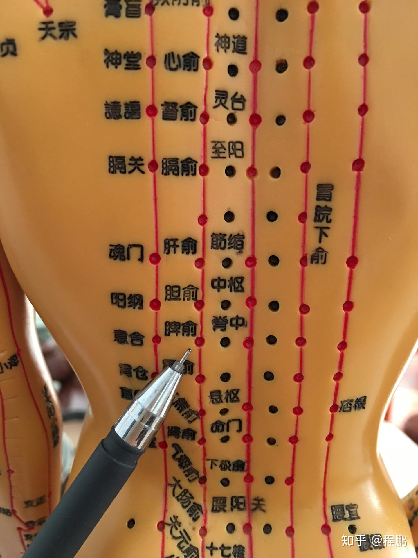巧用拔罐调理肾炎 - 知乎