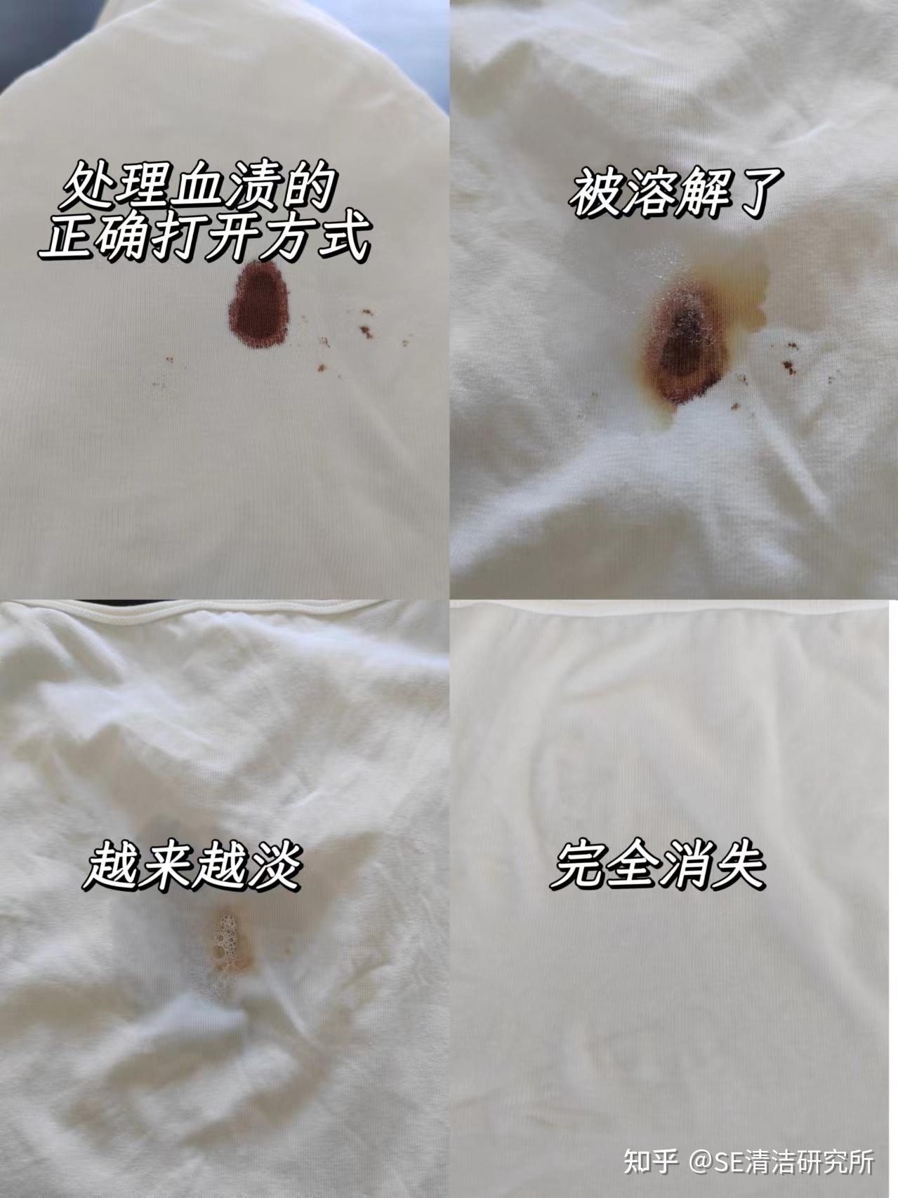 女生不小心将姨妈血渍弄衣服上,如何清洗? - 知乎