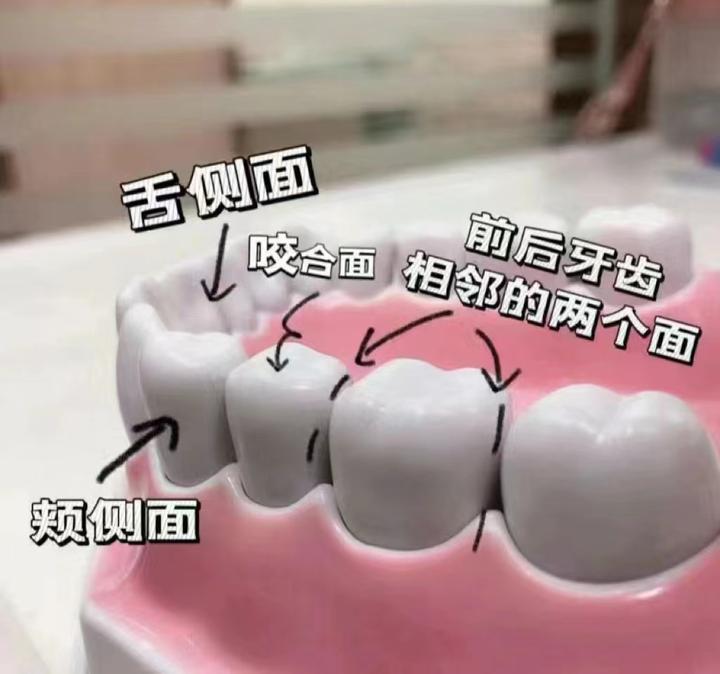 每颗牙齿都有5个面,你平时刷了哪几个面?