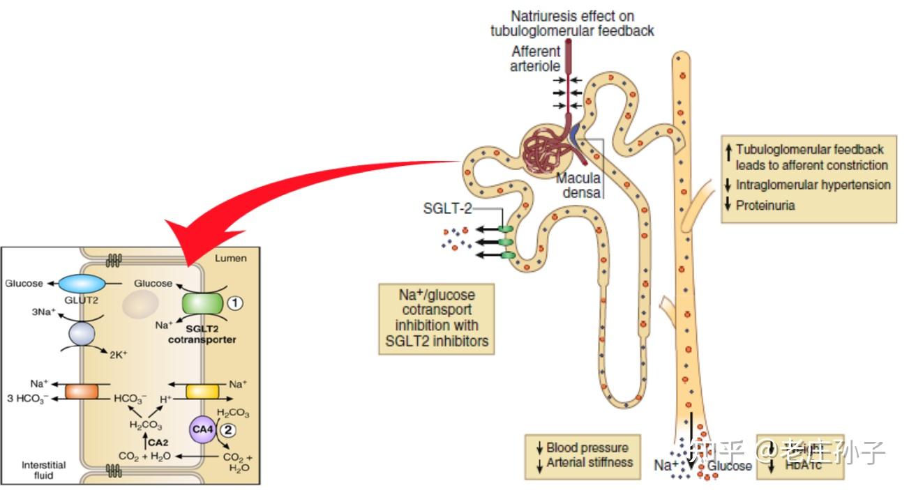 糖尿病新药SGLT2抑制剂，何以号称胜过二甲双胍？ - 知乎
