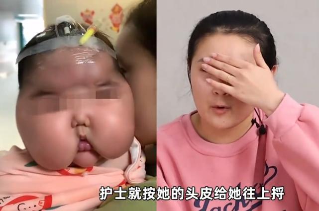 如何看待宝宝霜益芙灵开心森林激素含量超标婴儿用后成大头娃娃这种