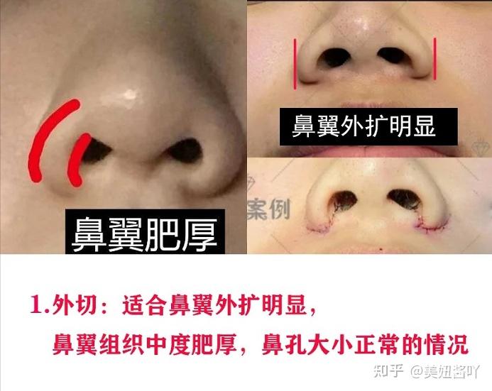 鼻子大一定很丑吗?盘点娱乐圈的大鼻子女明星 - 知乎