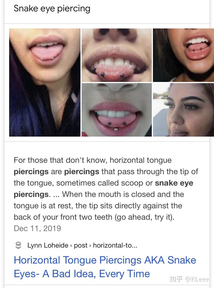 舌钉的位置可以打在舌头末端两边吗? - 知乎