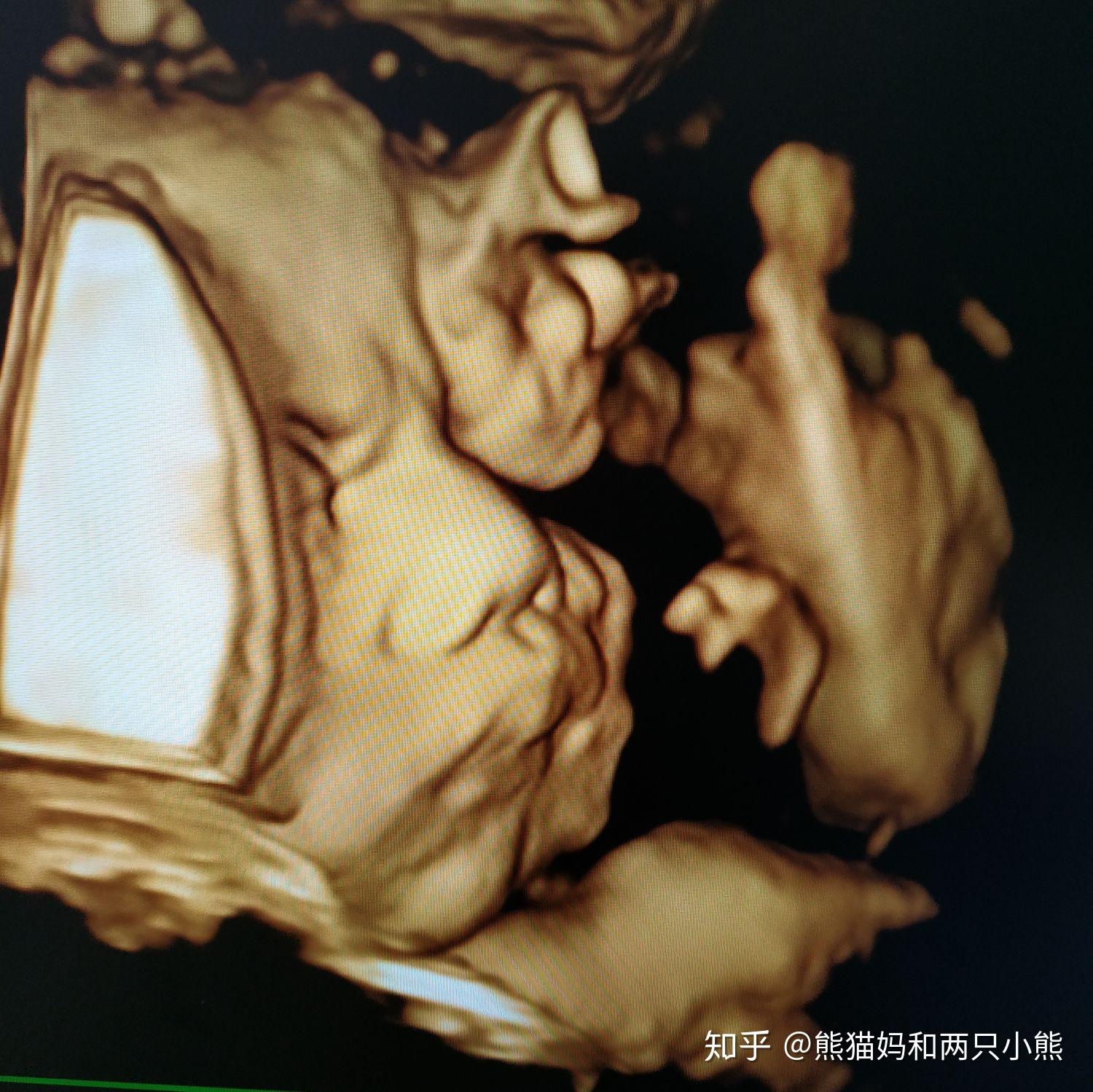感觉胎儿在肚子里经常拱来拱去,那时胎宝宝在做什么? - 知乎
