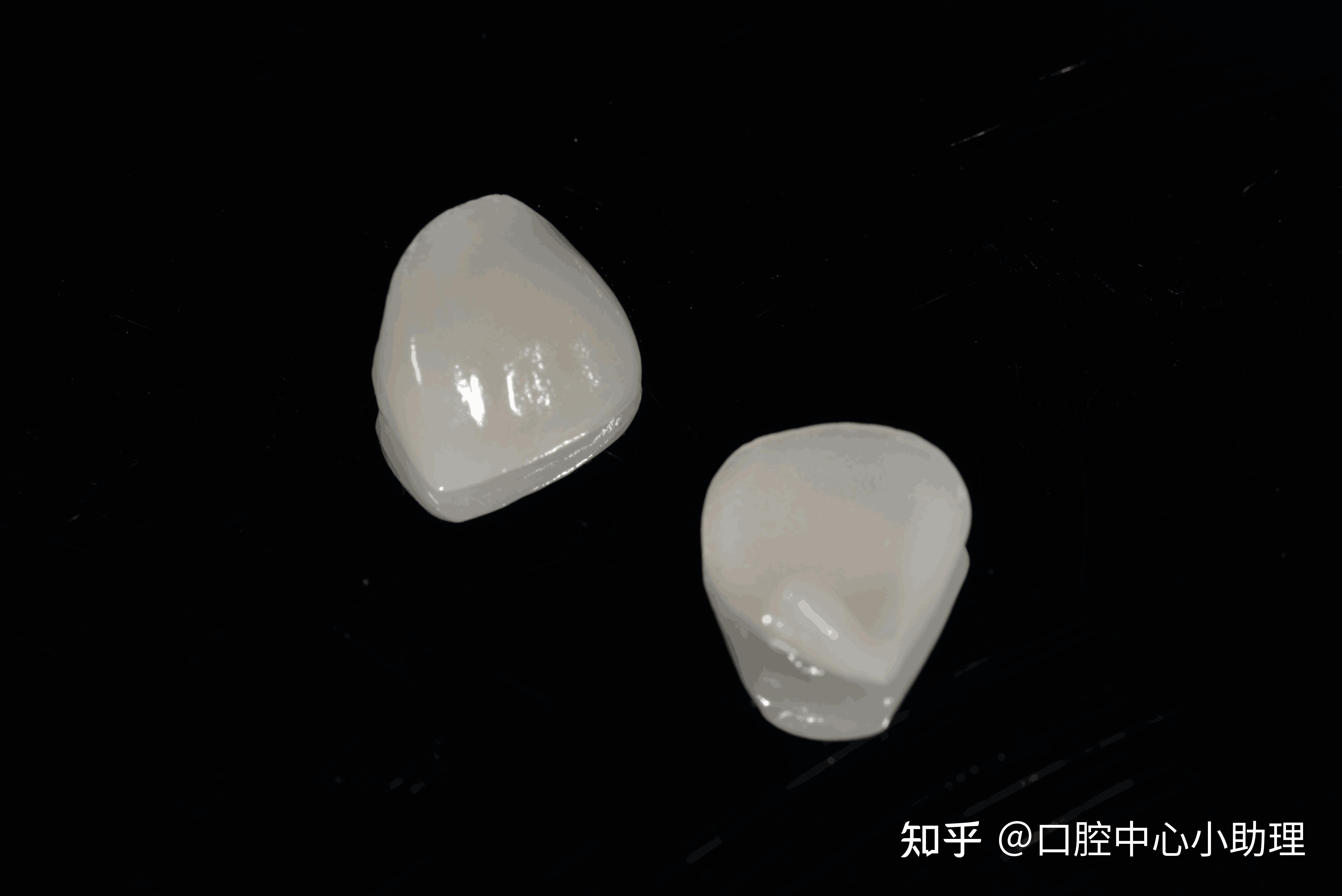 上齿/上海奇异 复色合成树脂牙(曾用名:盛建) 6*1 前牙 上 型号:23 色号:A2（新老包装随机发货）