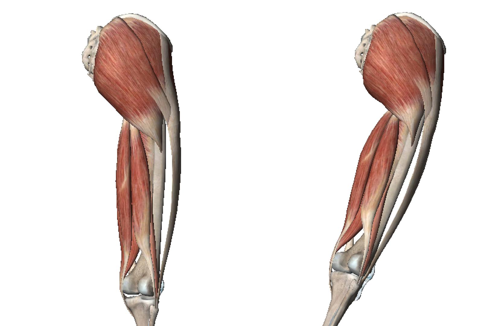 大腿前侧的肌肉过于发达怎么办