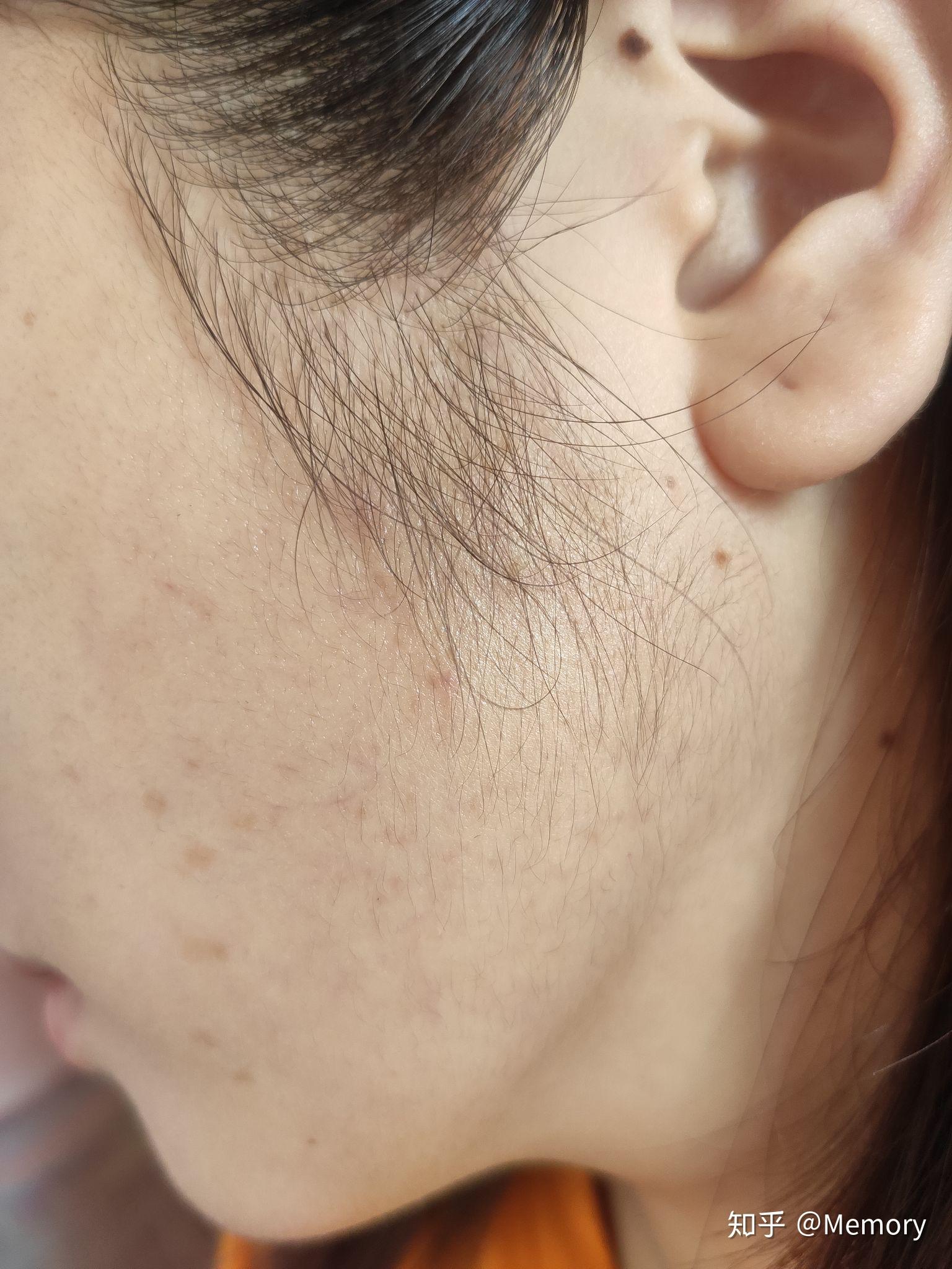 女生鬓角头发多且浓厚是一种怎么样的体验? - 知乎