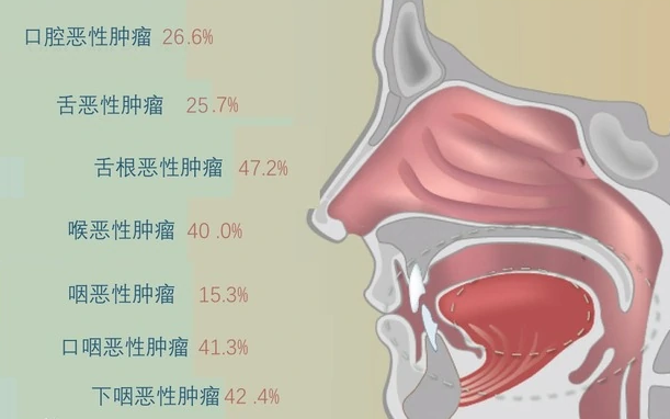 正确认识头颈部肿瘤 - 知乎