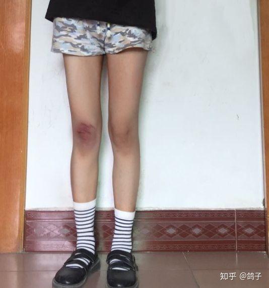 小腿围32真的不胖吗