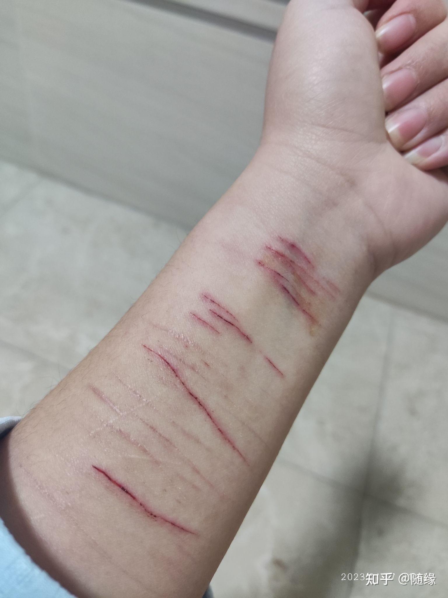 自残留下的疤真的很可笑吗