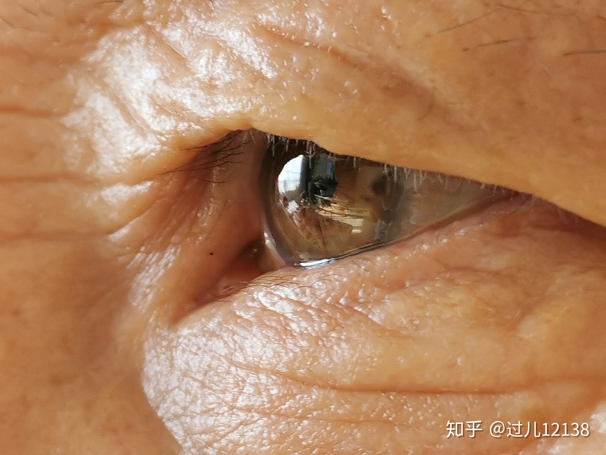 有和我一样天生绿眼睛的中国人么? - 知乎