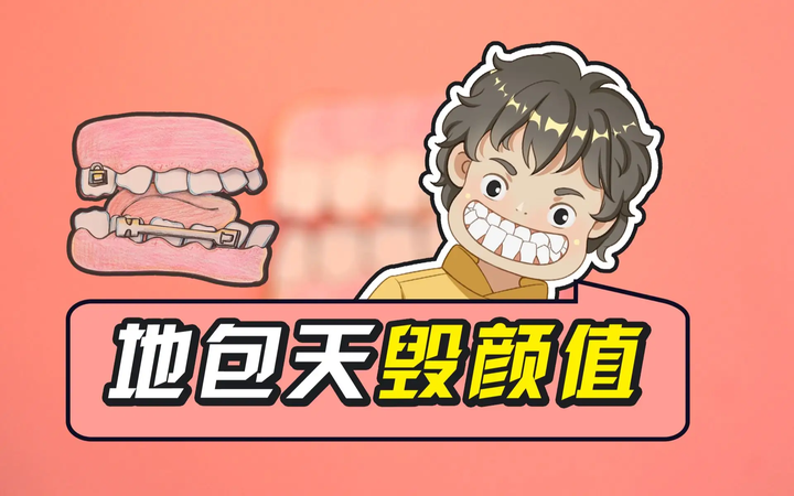 地包天有必要矫正吗?地包天不矫正会有什么后果? - 知乎