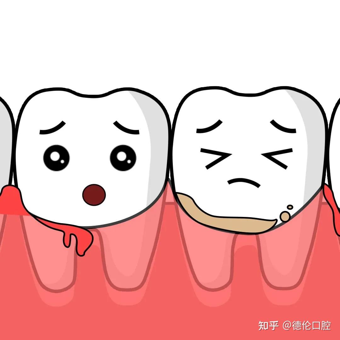 牙外伤紧急处理与后续应对,看完这篇全知道! - 知乎
