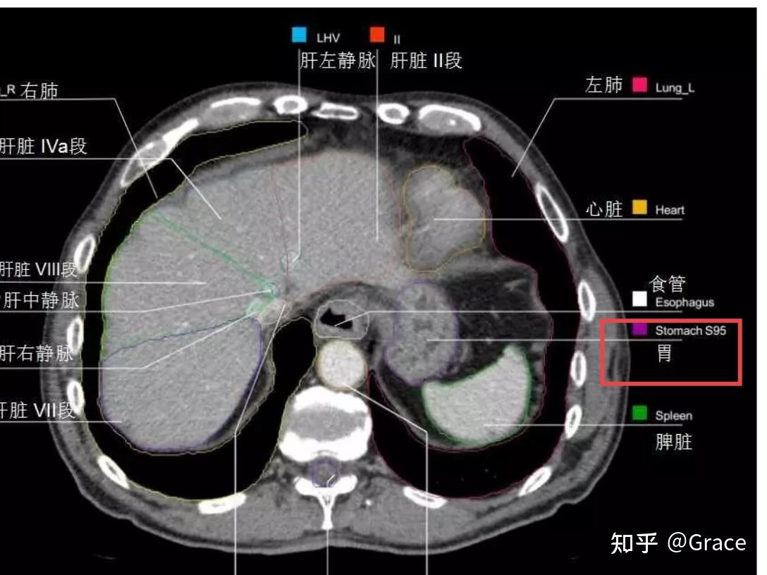 本人想做除胃镜以外的胃部的影像学检查,腹部ct检查包括胃部吗?