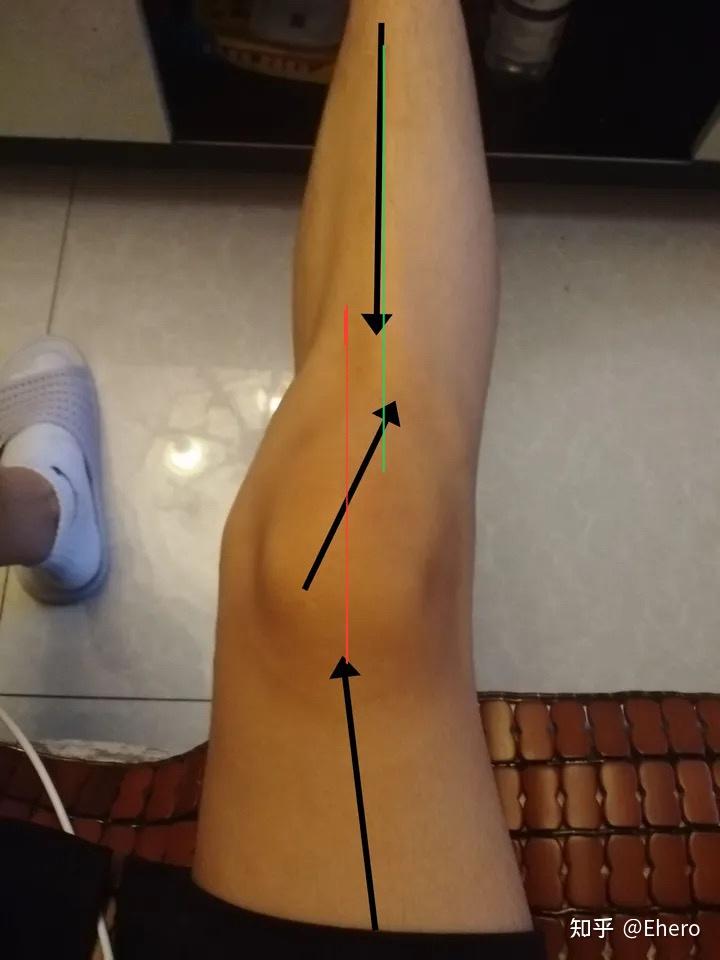 膝盖弯曲45度的图片图片