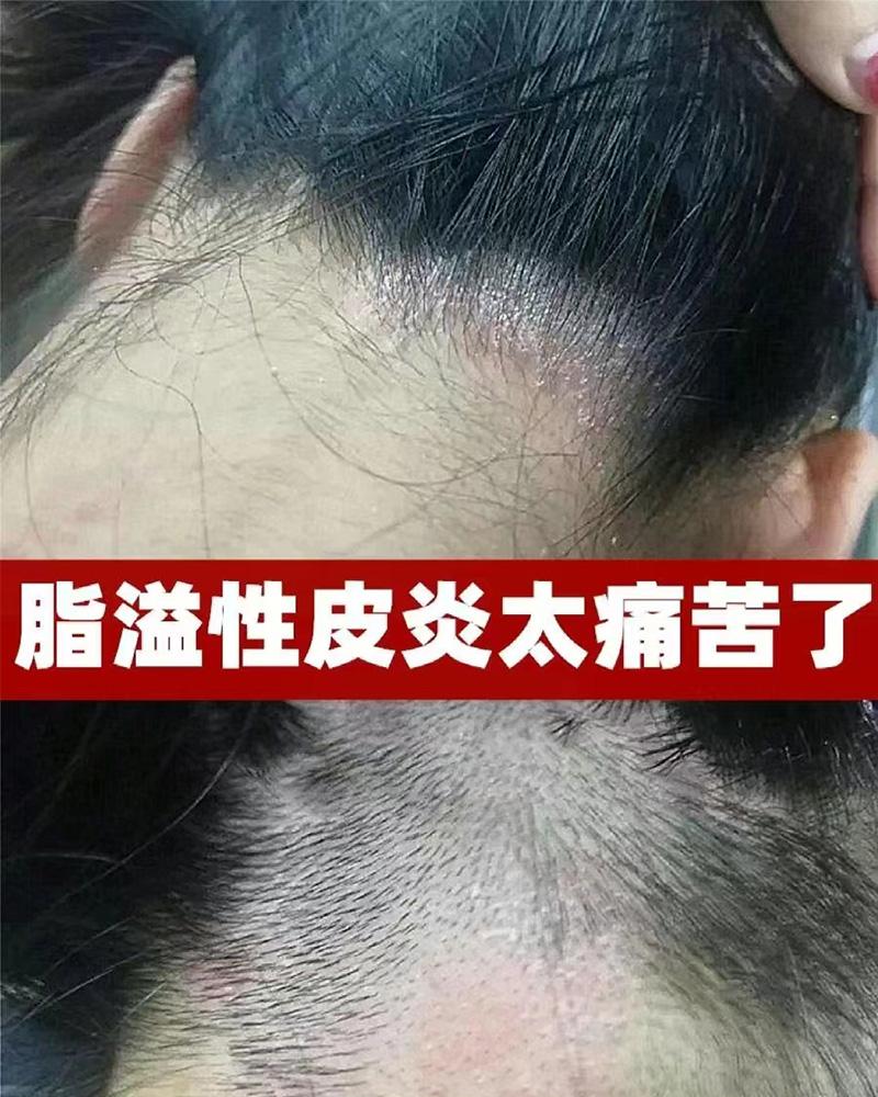 为什么头痒