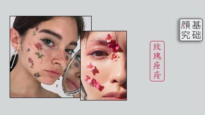 可怕的毁容式皮肤病,千万别掉以轻心 - 知乎