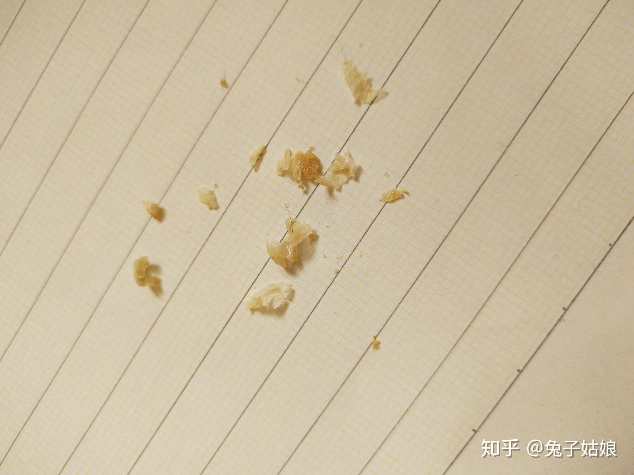 耳屎能大到什么程度