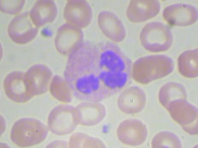 Complete Blood Count 全血细胞计数数据集介绍 - 知乎