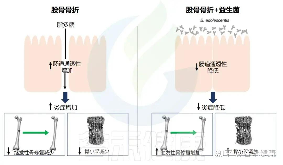 青春双歧杆菌(Bifidobacterium adolescentis)——功能性食品和微生物疗法中的明星菌种 - 知乎