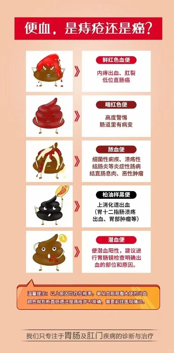 便血了怎么回事 是痔疮还是癌 一图教你“ - 知乎