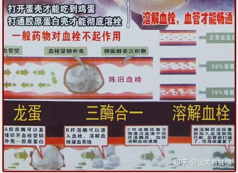 有没有专门可以溶解血栓的药物？ - 知乎