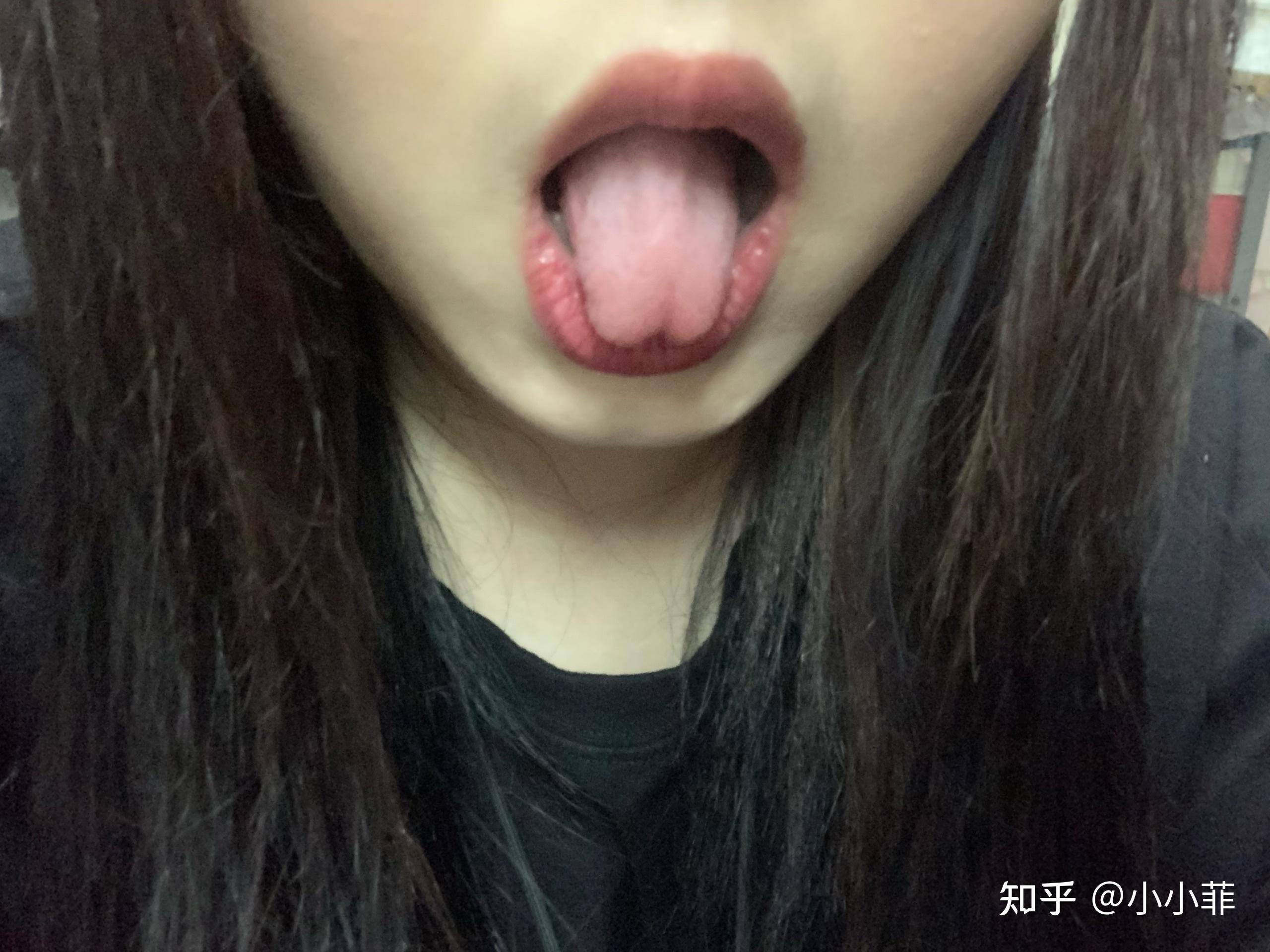 如果人的舌头分叉,类似蛇那样,会怎么样? - 知乎