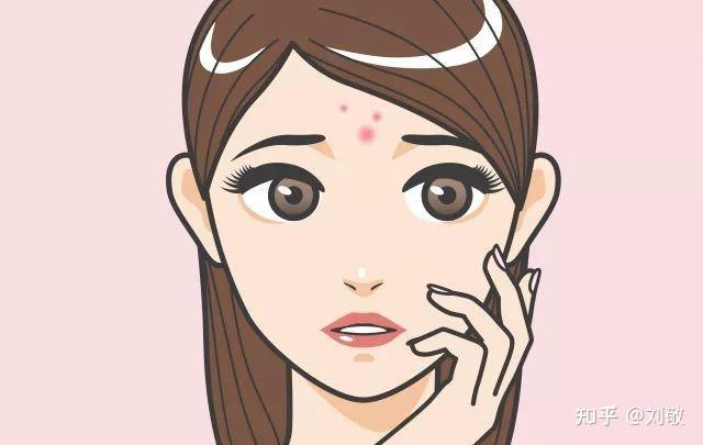 额头一直长痘反反复复下去,上来怎么回事? - 知乎