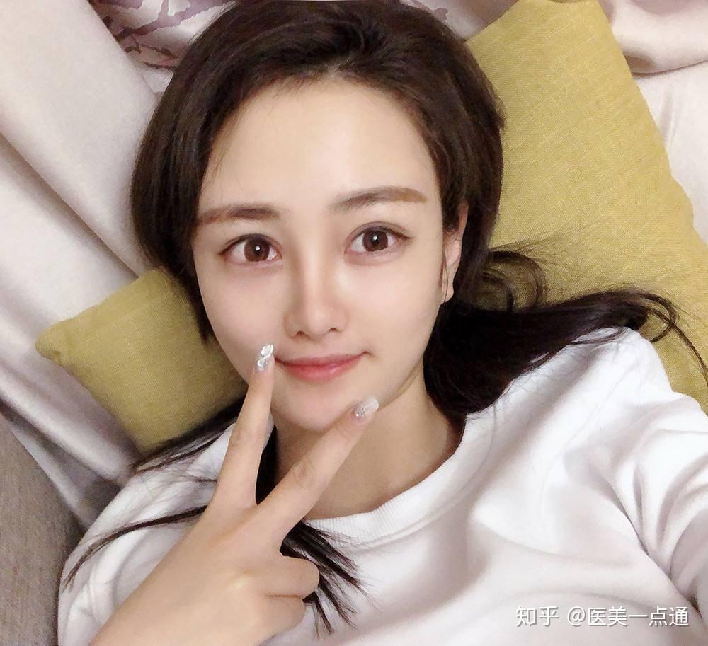 请问我这是什么眼型呀?眼尾后还有一道挺深的沟,一直想知道那个是啥?