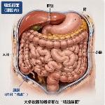 深圳女子受精卵钻入腹膜后的空间，为什么会出现这种情况？医生是怎么成功找到的？这种宫外孕有什么症状？