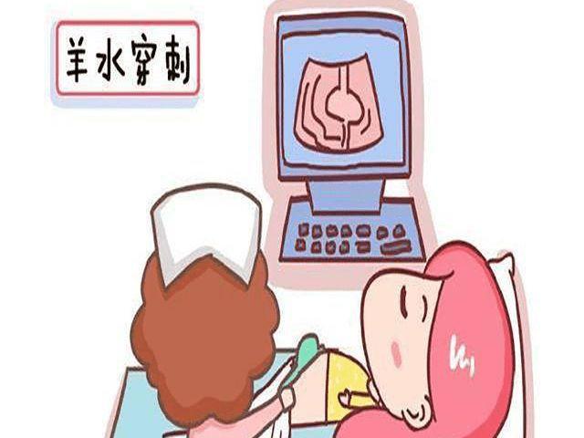 产检有时候检查需要做羊水穿刺羊水穿刺疼吗