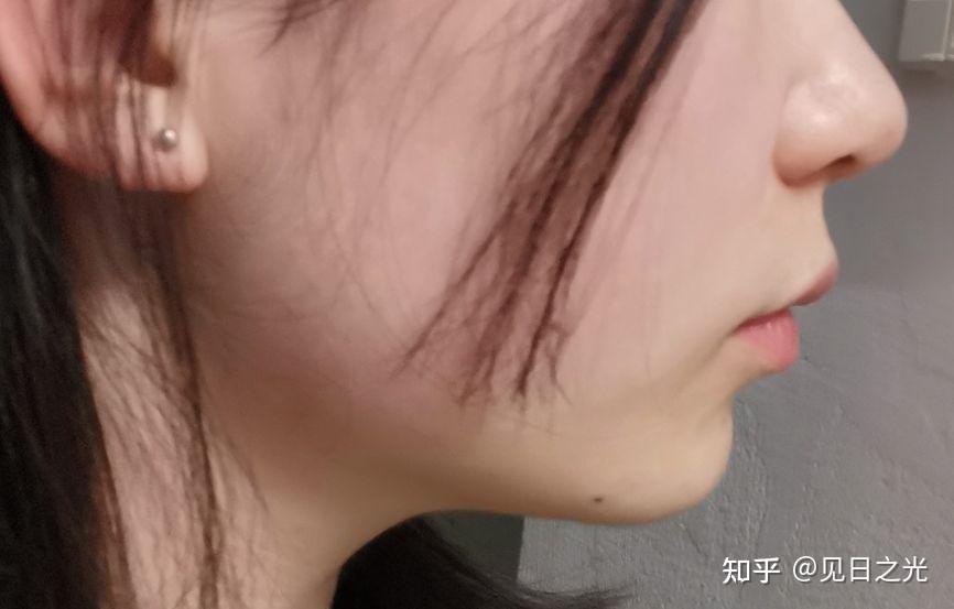 下颌后缩的女孩留什么发型好看?