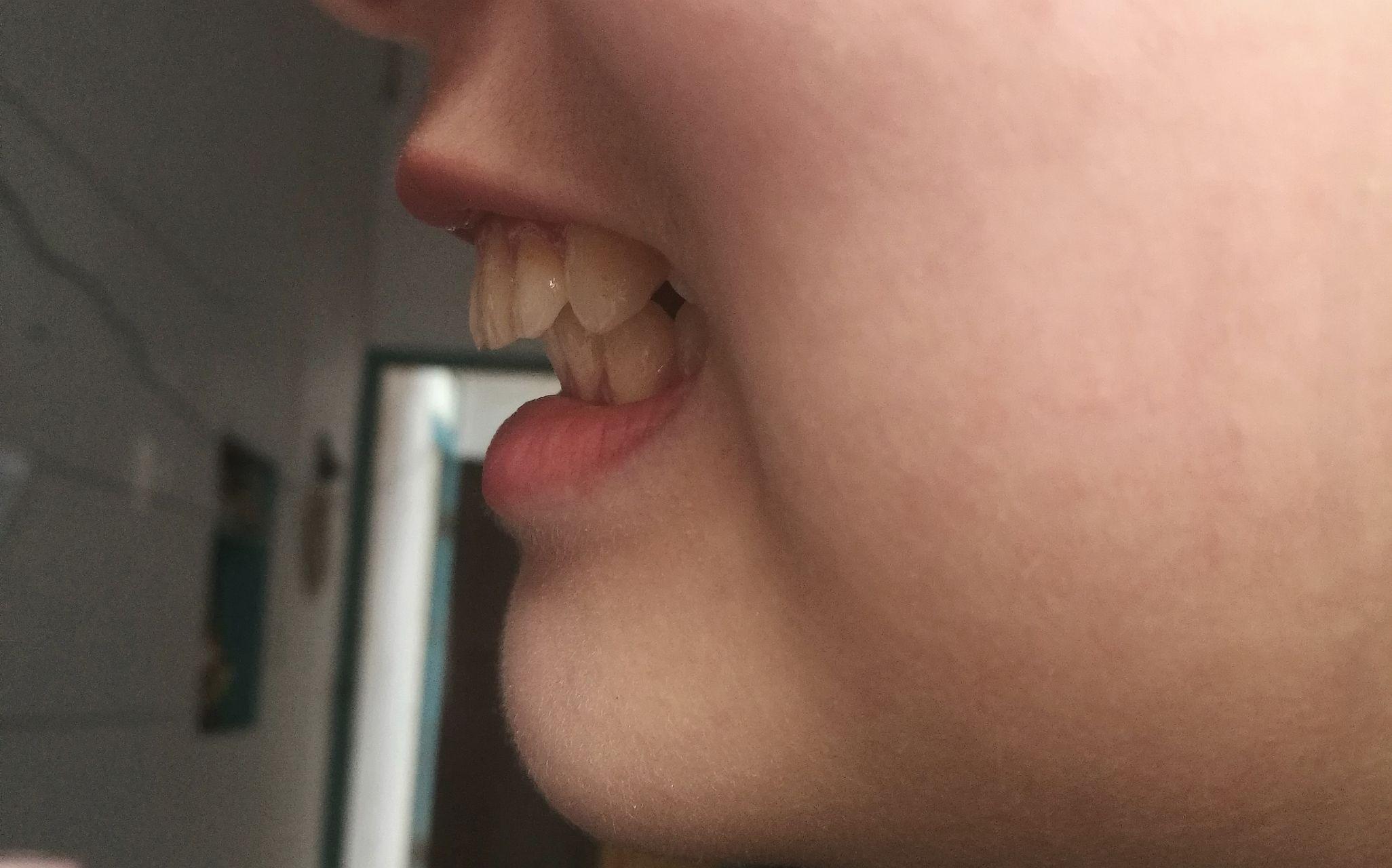 牙齿侧面怎样最好看? - 知乎