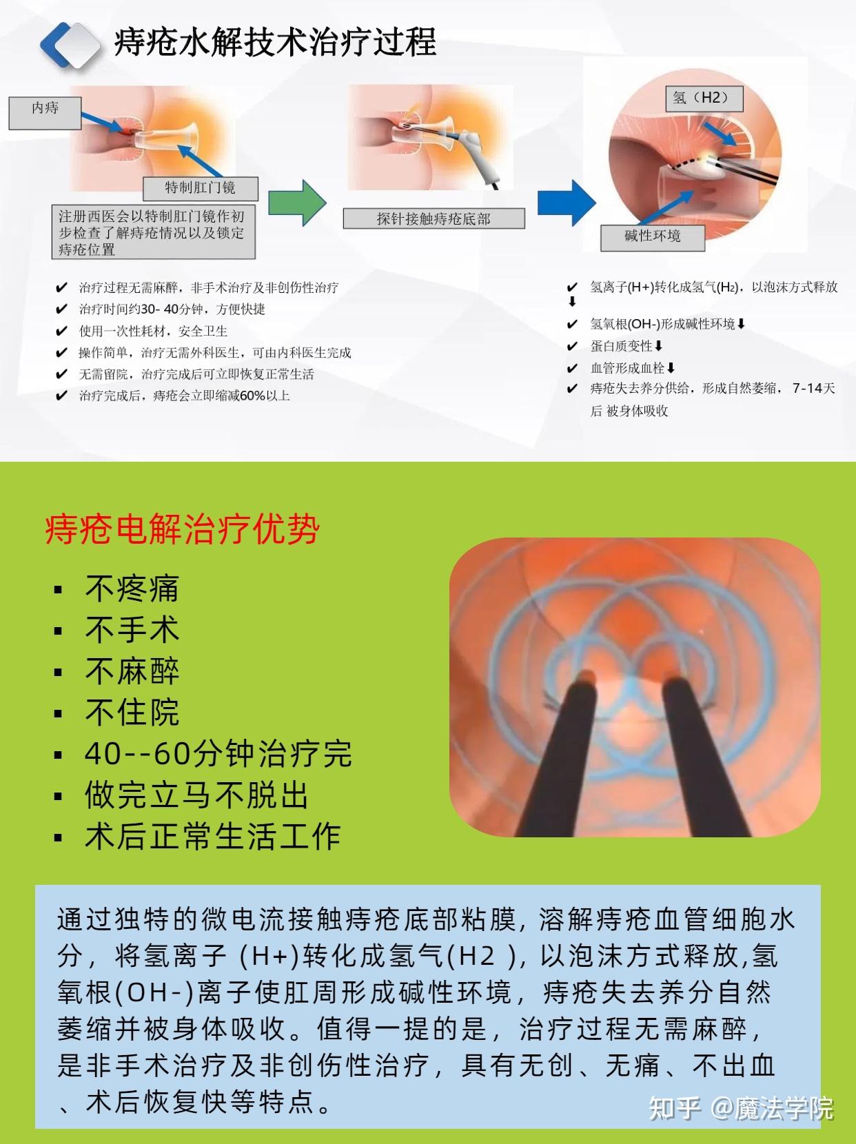 得了痔疮怎么治?