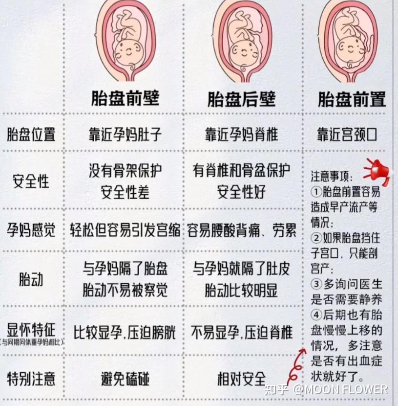 胎盘前壁和后壁有什么区别